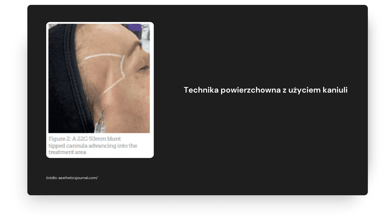 Medycyna estetyczna kurs