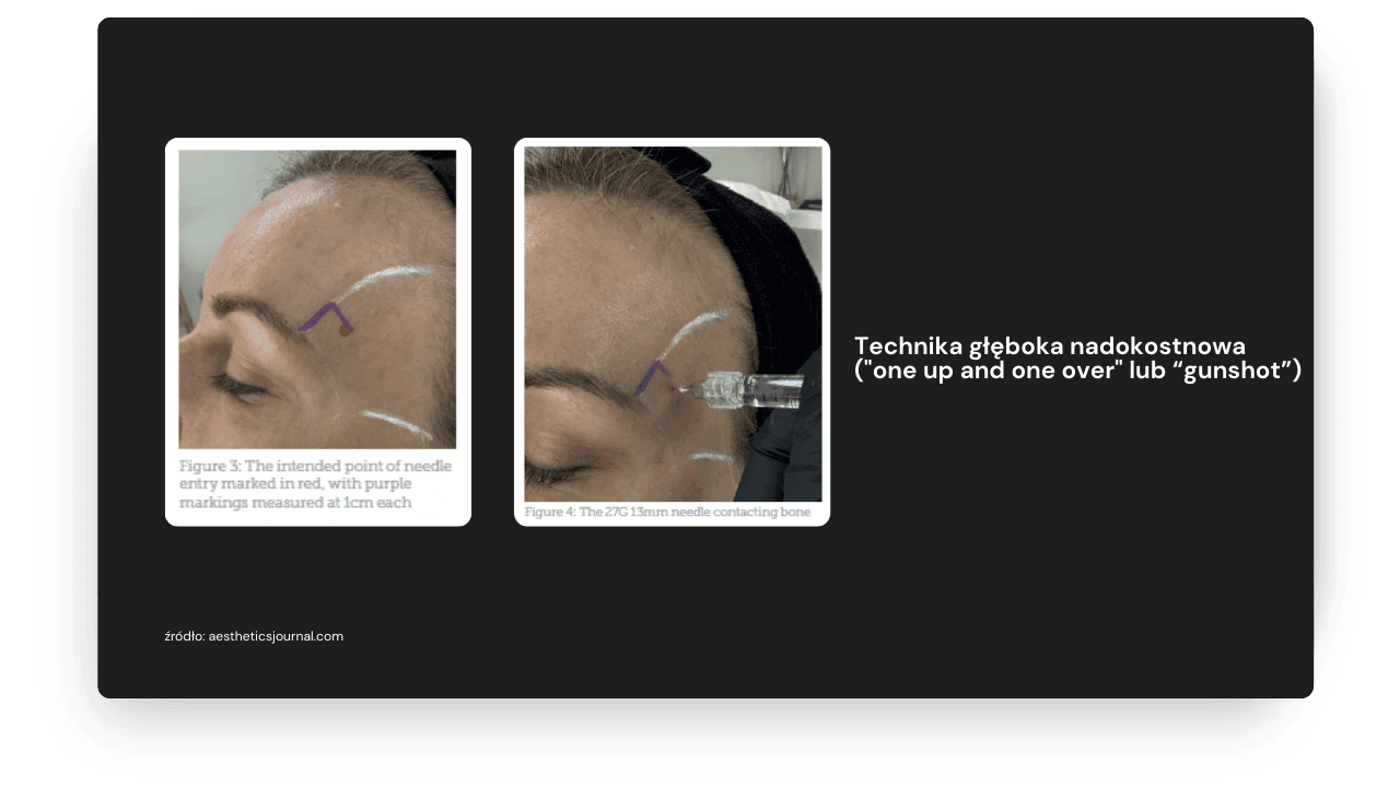 Medycyna estetyczna kurs