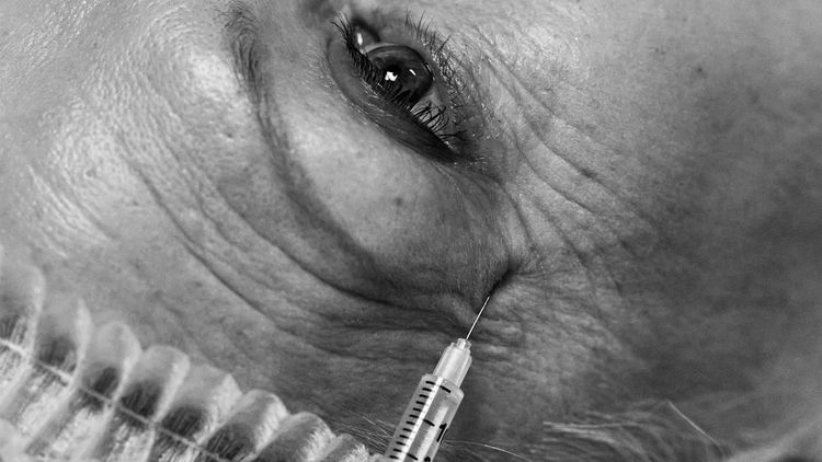 Odbudowa okolicy skroni | Anatomia, starzenie i świadomy wybór techniki