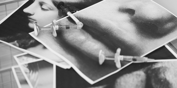 Asymetria po powiększaniu ust – co wynika z anatomii, a nie z zabiegu