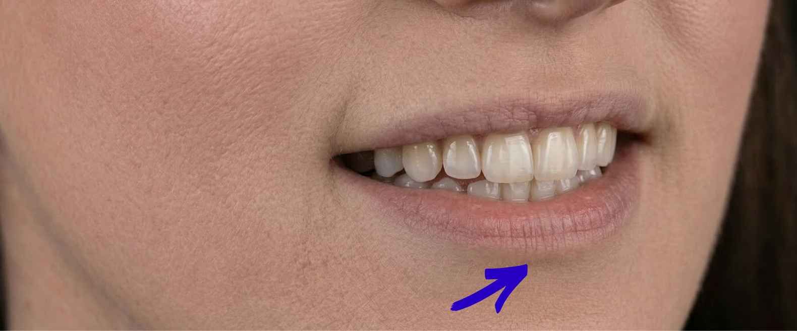 zdjecie asymetria2.jpg